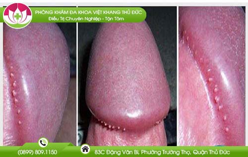 mun-nho-mau-trang
