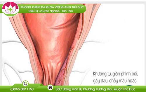 neu-bi-tri-nhe-co-tu-het-khong