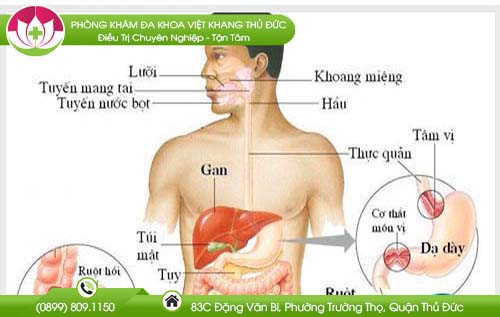 ngoi-nhieu-bi-tri