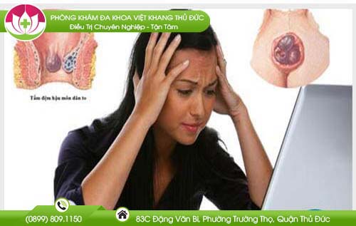 Tại sao ngồi nhiều bị trĩ? Cách chữa trĩ nhanh chóng