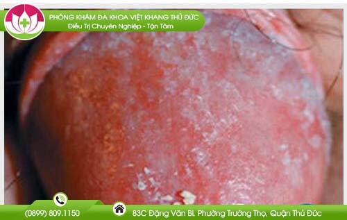 ngua-o-dau-duong-vat