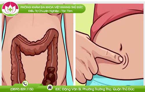 Nguyên nhân đau bụng chảy máu hậu môn