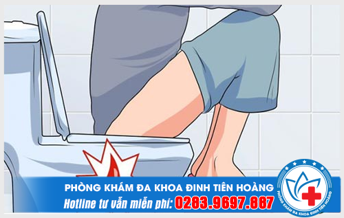 Nguyên nhân, dấu hiệu và biến chứng của bệnh trĩ ngoại