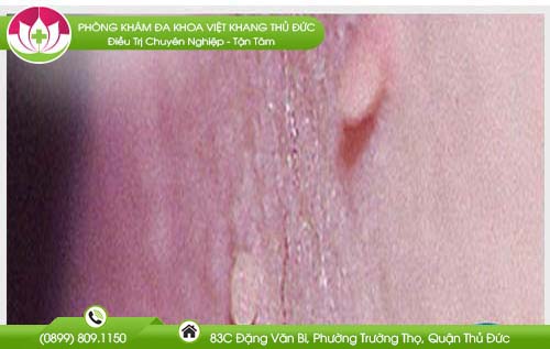 noi-hot-o-vung-kin-nu