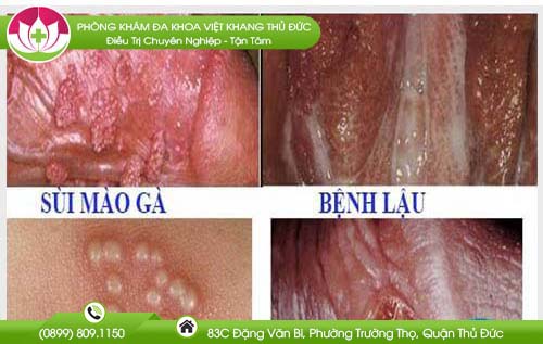 noi-man-do-ngua-o-hang