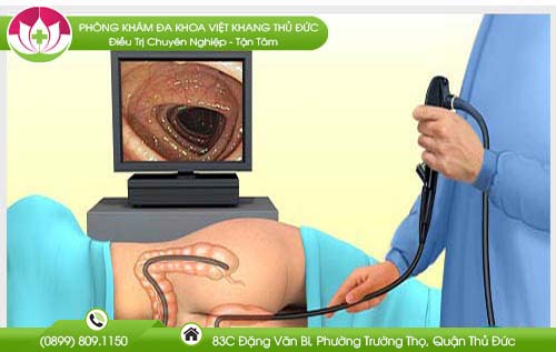 Nội soi đại tràng có phát hiện được ung thư không?