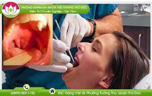 Nước mũi chảy xuống họng là dấu hiệu bệnh gì? Cách xử lý hiệu quả