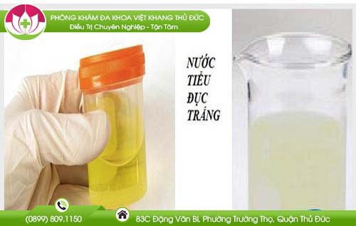 nuoc-tieu-mau-trang-duc