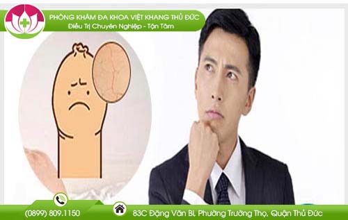 Nứt da bao quy đầu - Tìm hiểu nguyên nhân và cách chữa bệnh an toàn