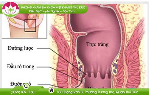 Ống hậu môn là gì và cấu tạo của ống hậu môn