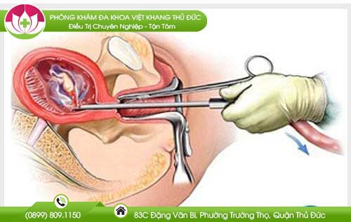 pha-thai-14-tuan-bang-thuoc