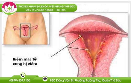 pha-thai-lan-2-co-nguy-hiem-khong