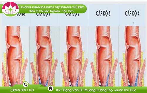 phong-tranh-benh-tri