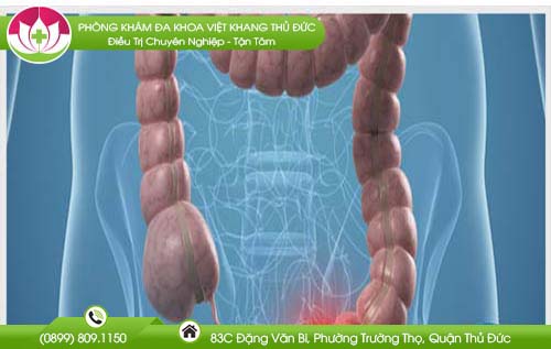 Rối loạn đại tiện là gì, nguyên nhân và cách khắc phục