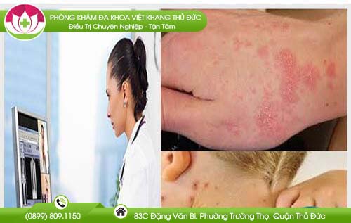 so-dien-thoai-benh-vien-da-lieu-tp-hcm