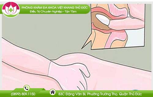 su-dung-dung-dang-thuoc-dat-hau-mon