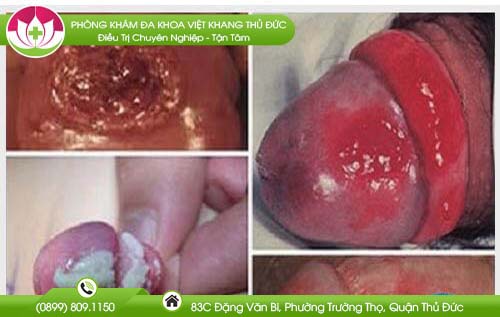 sung-bao-quy-dau-sau-khi-quan-he
