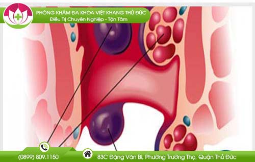 tac-mach-tri-la-gi-va-co-nguy-hiem-khong