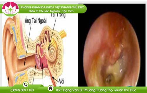 tai-chay-nuoc-vang