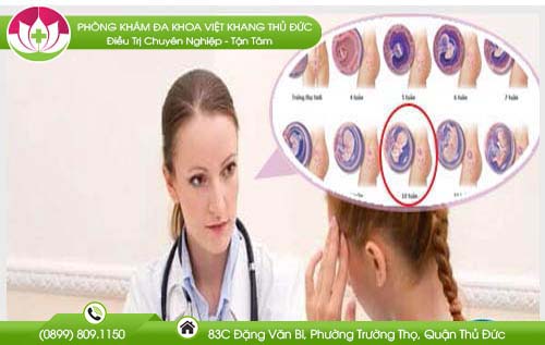 Thai 10 tuần có phá được không? Chuyên gia tư vấn phá thai an toàn
