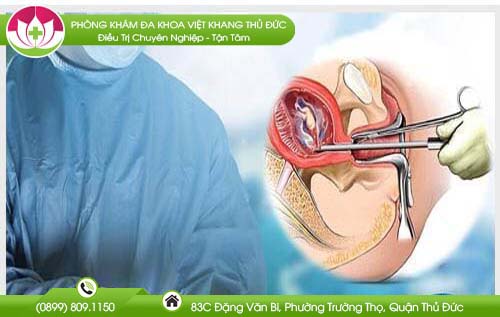 thai-14-tuan-co-pha-duoc-khong