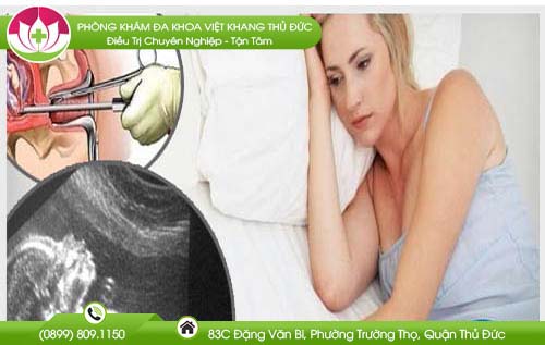 Thai 15 tuần có phá được không và hết bao nhiêu tiền?