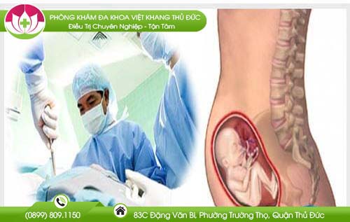 Thai 5 tháng có phá được không? Phá bằng cách nào an toàn