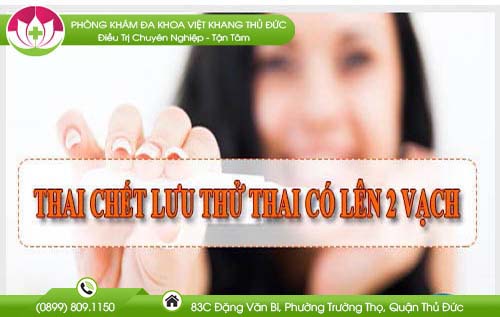 Thai chết lưu thử que có lên 2 vạch không? Chia sẻ từ chuyên gia