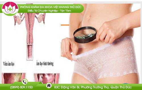 thuoc-canvey-bao-nhieu-tien