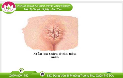 tong-hop-cac-hinh-anh-thit-thua-o-hau-mon