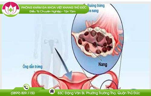 tre-kinh-1-tuan-nhung-khong-co-thai