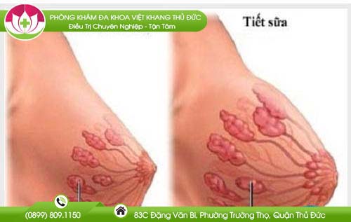 trieu-chung-co-thai