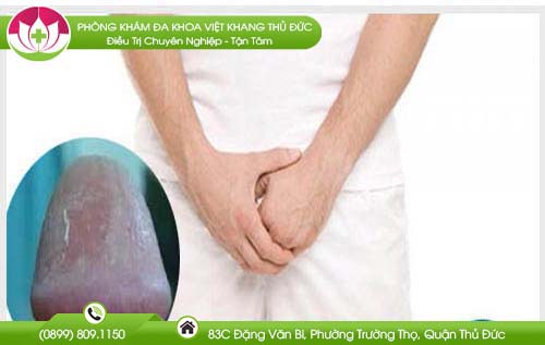 Tróc da bao quy đầu là bị gì và cách chứa trị dứt điểm