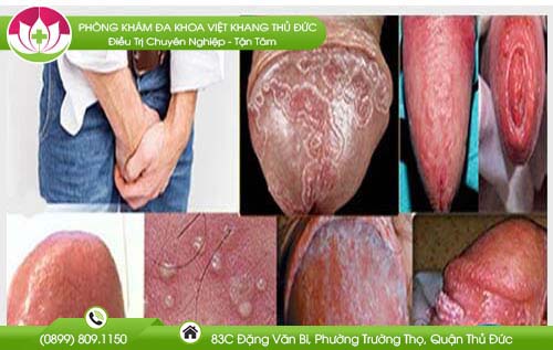 tu-van-nam-khoa-qua-dien-thoai