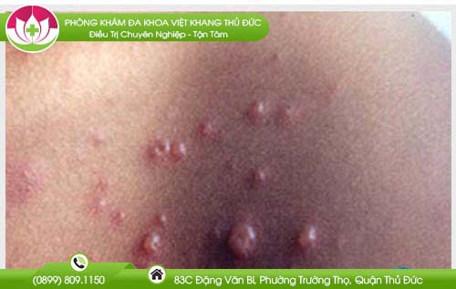 u-mem-lay-co-lay-khong