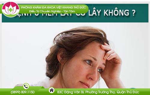 Tìm hiểu bệnh u mềm lây có lây không và cách điều trị nhanh chóng