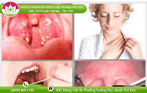 viem-amidam-co-lay-khong