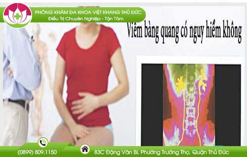 Viêm bàng quang có nguy hiểm không từ đánh giá của chuyên gia