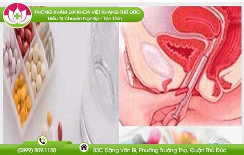 viem-quanh-lo-co-tu-cung