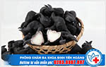 Cách chữa bệnh trĩ nội độ 2 - Đảm bảo nhanh chóng, hiệu quả