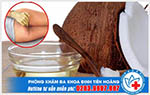 Chữa bệnh trĩ nội, trĩ ngoại bằng dầu dừa - Giải pháp hữu hiệu