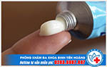 Dùng thuốc bôi có chữa khỏi bệnh trĩ được không?