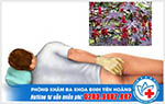 Lá thầu dầu tía thần dược vàng chữa bệnh trĩ bạn nên biết