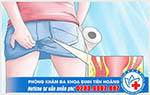 Lỗ hậu môn bị sưng to và ngứa bên trong phải làm sao?